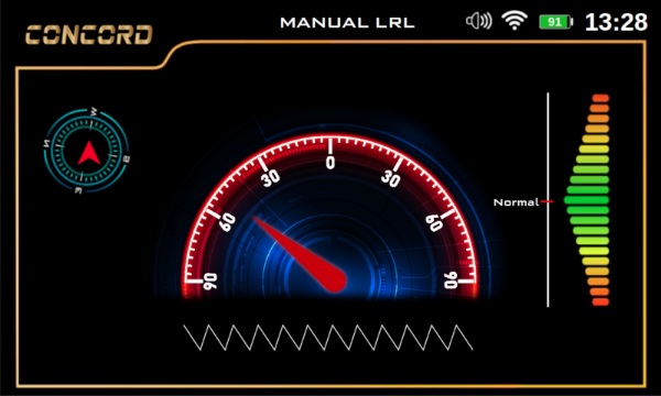 manual LRL screen